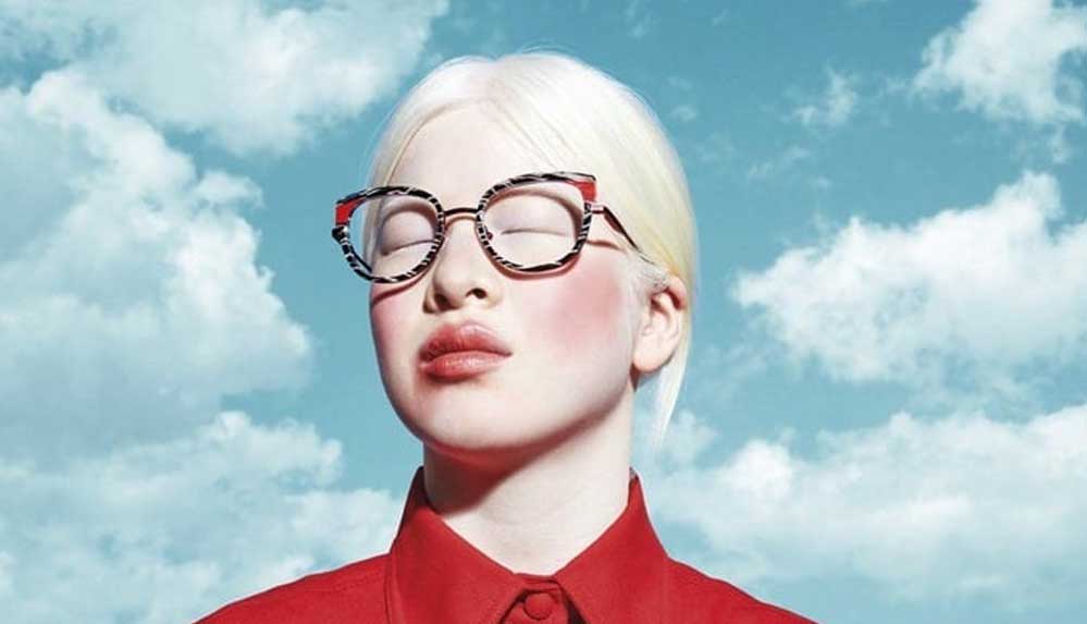 Bebekken görünüşü yüzünden terk edilmişti, Vogue modeli oldu 6 Bebekken-görünüşü-yüzünden-terk-edilmişti,-Vogue-modeli-1