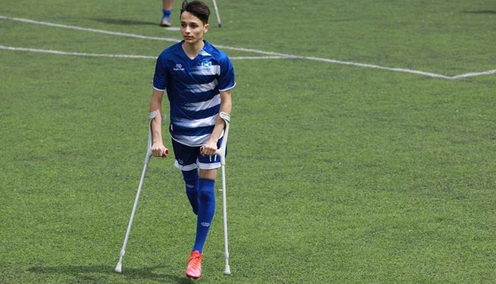 Kaybettiği ayağına rağmen futbol tutkusundan vazgeçmedi