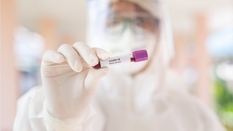 Koronavirüs varyantları ne kadar bulaşıcı olabilir? 3 Koronavirüs varyantları ne kadar bulaşıcı olabilir?