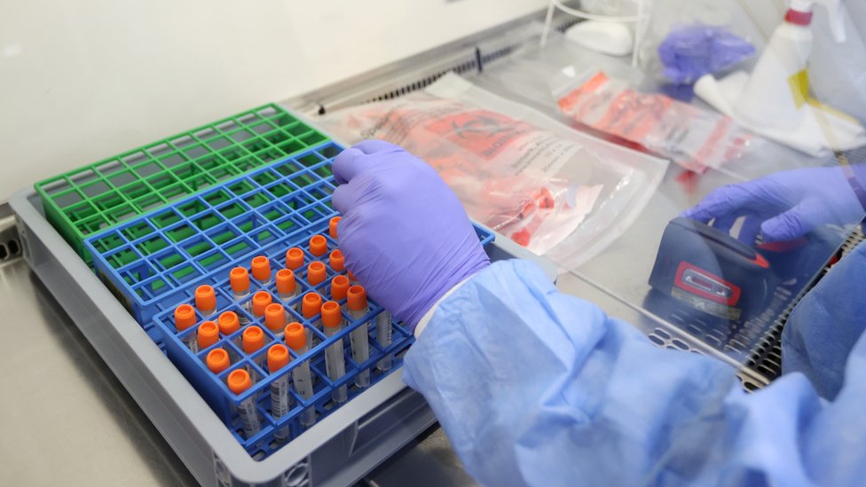 Koronavirüs varyantları ne kadar bulaşıcı olabilir? 5 Koronavirüs varyantları ne kadar bulaşıcı olabilir?