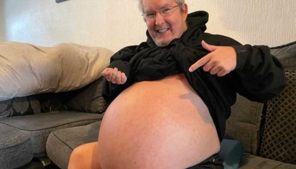 30'ar kiloluk "Rekor boyuttaki" böbreklerini ameliyatla aldıracak 4 30'ar-kiloluk-'Rekor-boyuttaki'-böbreklerini-ameliyatla-aldıracak