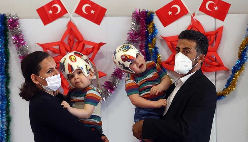 Ameliyatla-ayrılan-siyam-ikizleri-3-yaşında