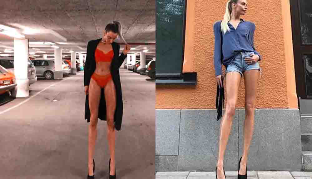 Sosyal medyanın gündemine oturdu: Bir metreden fazla bacak boyuyla rekora koşuyor