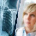 Zatürre (Pnömoni) nedir Zatürre belirtileri nelerdir, tedavisi nasıl olmalı