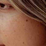 Vücuttaki benlerin gösterdiği değişimlere dikkat edilmesi gerekiyor