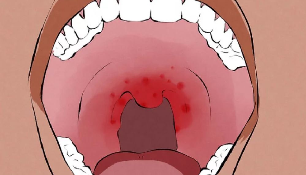 Ağız kanserlerinin en önemli nedeni sigara