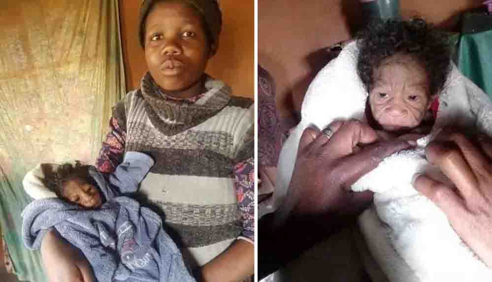 Benjamin Button gerçek oldu Kendisinden daha yaşlı görünen bir bebek dünyaya getirdi