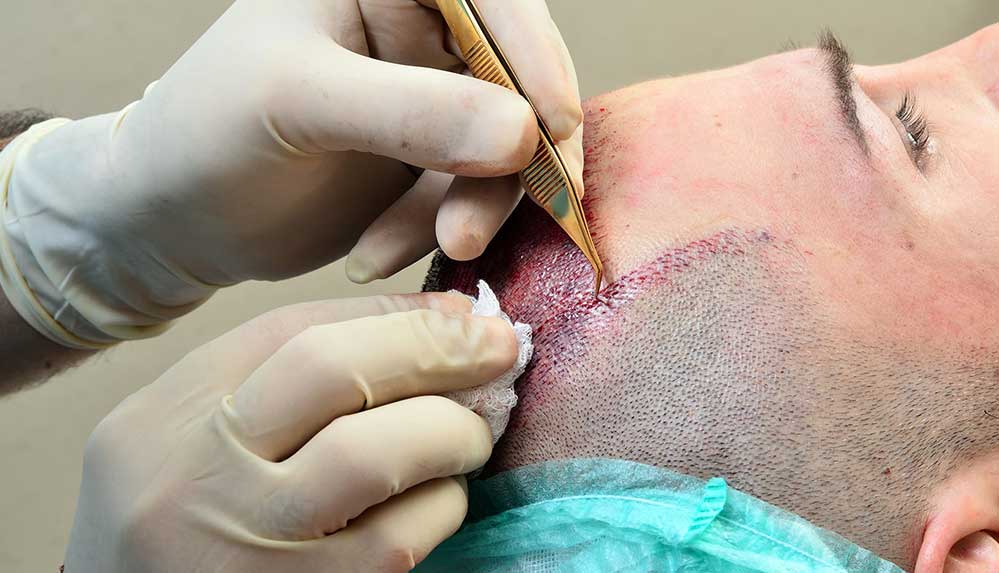 Memorial-Bahçelievler-Hastanesi