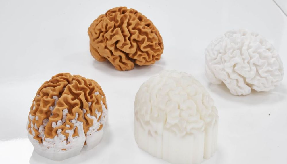 Türkiye’de ilk kez yaşayan bir insan beyninin 3D kopyası yapıldı!