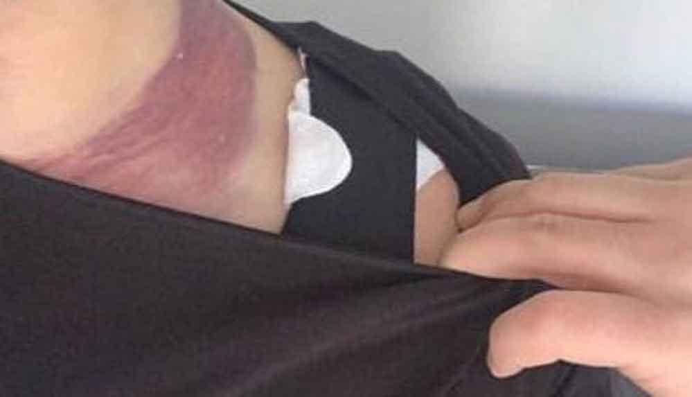 Yağ aldırırken ölümden dönen Alişan'dan doktora rekor tazminat davası