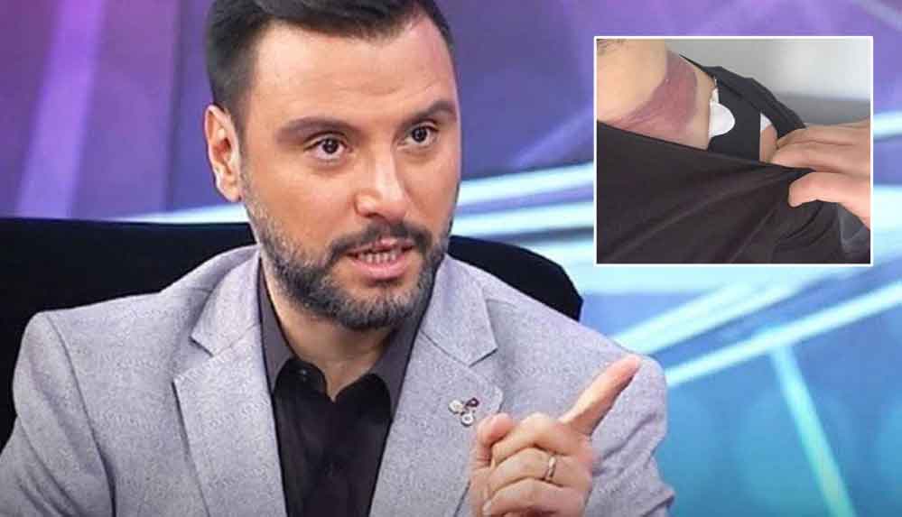 Yağ-aldırırken-ölümden-dönen-Alişan'dan-doktora-rekor-tazminat-davası-2