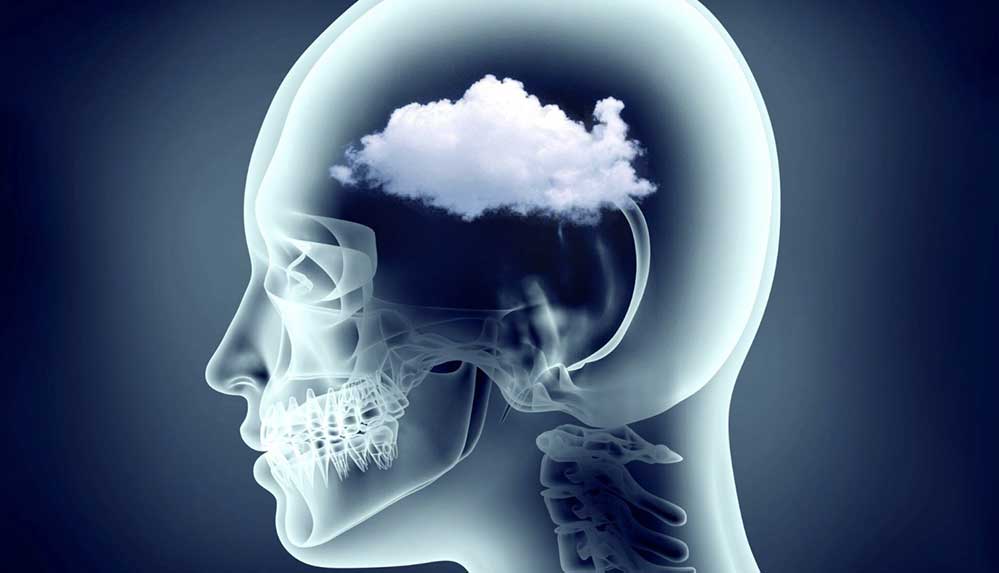 Uzmanlardan beyin sisi uyarısı: Kovid-19'un uzun vadeli etkilerinden