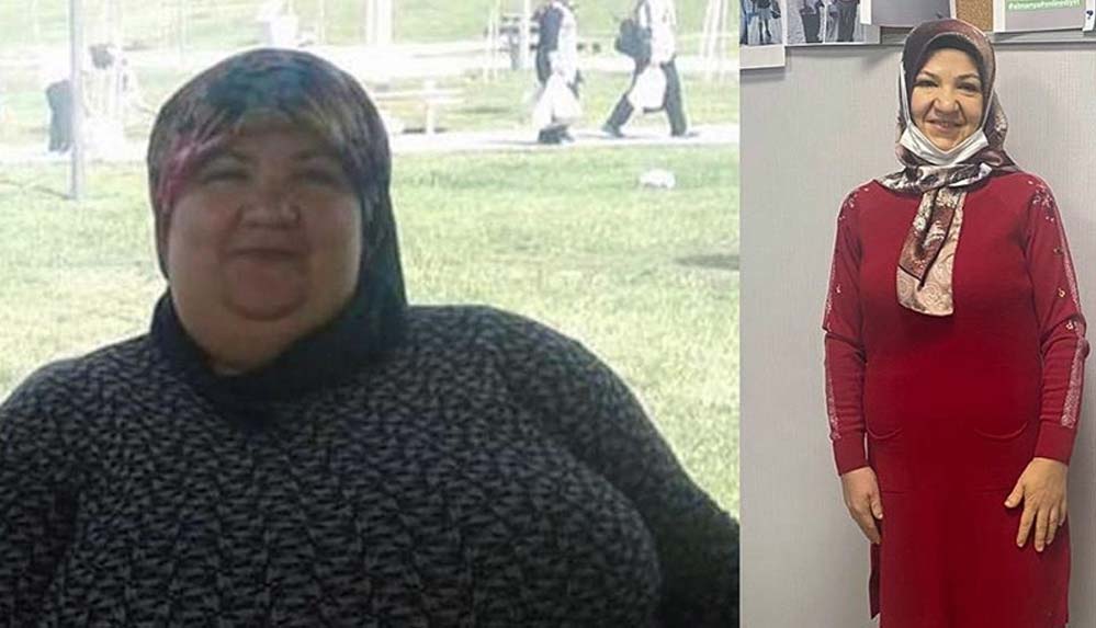 Sağlıklı-yaşam-için-azmetti-95-kilo-verdi-1