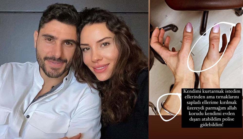 Futbolcu-Özer-Hurmacı'ya-eşi-Mihriban-Hurmacı'dan-dayak-iddiası--Sen-bir-canavarsın