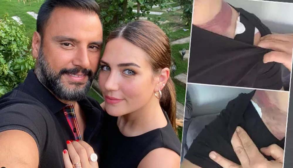 2-milyonluk-davada-Alişan'ın-tanığı-eşi-Buse-Varol