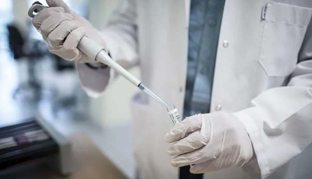 Maymun-çiçeği-şüphesi--Bakan-Fahrettin-Koca-4-kişinin-test-sonucunu-açıkladı