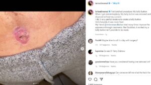 Instagram fenomeni Larissa Lima: Göbek deliğimi kaybettim