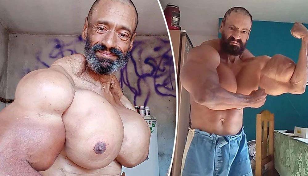 ‘Brezilyalı-Hulk’-olarak-tanınıyordu...-Uyarıları-ısrarla-dinlemedi,-doğum-gününde-hayatını-kaybetti!