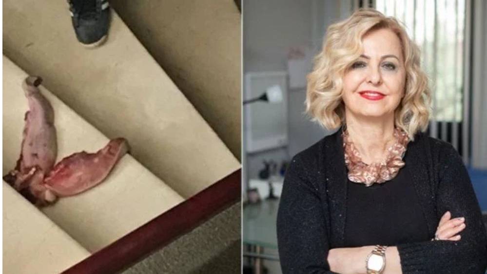 Prof. Dr. Esin Davutoğlu Şenol'u ölümle tehdit eden zanlı gözaltına alındı