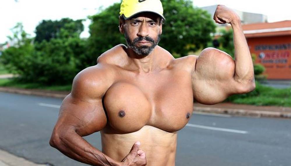 ‘Brezilyalı Hulk’ olarak tanınıyordu... Uyarıları ısrarla dinlemedi, doğum gününde hayatını kaybetti!