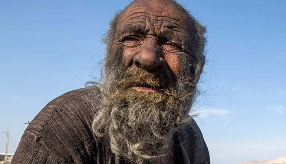 50-yıldır-banyo-yapmayan-adam-94-yaşında-yaşamını-yitirdi