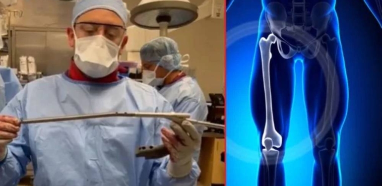 Uzman doktor paylaştı: Ameliyatla boy nasıl uzatılıyor?