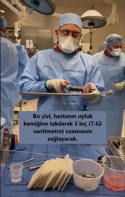 Uzman doktor paylaştı: Ameliyatla boy nasıl uzatılıyor?