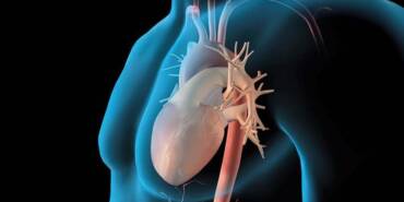 Aort-anevrizması-nedir--Risk-faktörleri-nelerdir--Aort-anevrizması-tedavisi-nasıl-yapılır-