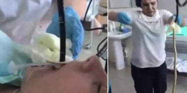 Hastanın-midesinden-yılan-çıkarıldı!-“Bunca-yıllık-doktorum,-ilk-kez-böyle-bir-vaka-görüyorum”