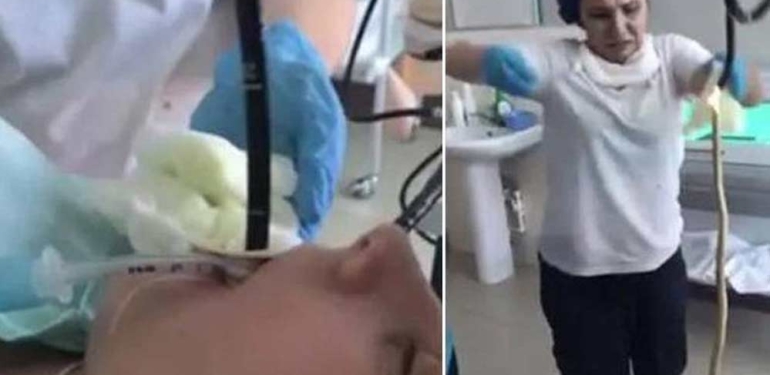 Hastanın-midesinden-yılan-çıkarıldı!-“Bunca-yıllık-doktorum,-ilk-kez-böyle-bir-vaka-görüyorum”