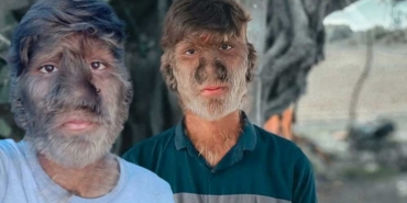 Hintli-'kurt-adam'-Lalit-Patidar--Arkadaşlarım-bana-'maymun'-diye-bağırırdı