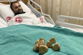Mesanesinden-yarım-kilo-taş-çıkartıldı--Bu-boyutlarda-pek-rastlanmıyor-