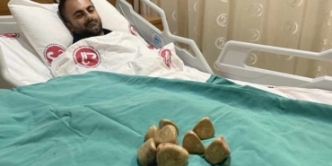 Mesanesinden-yarım-kilo-taş-çıkartıldı--Bu-boyutlarda-pek-rastlanmıyor-