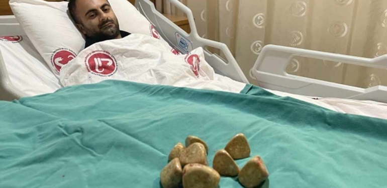 Mesanesinden yarım kilo taş çıkartıldı: Bu boyutlarda pek rastlanmıyor 1 Mesanesinden-yarım-kilo-taş-çıkartıldı--Bu-boyutlarda-pek-rastlanmıyor-
