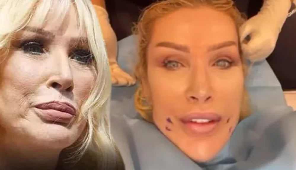 Seda-Sayan-estetik-operasyonlarına-bir-yenisini-daha-ekledi!-İşte-son-hali…