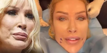 Seda-Sayan-estetik-operasyonlarına-bir-yenisini-daha-ekledi!-İşte-son-hali…