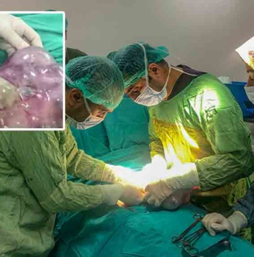 Van'da 15 yaşındaki kızın karnından 7,5 kilogram kitle çıktı 8 Van'da-15-yaşındaki-kızın-karnından-7,5-kilogram-kitle-çıktı