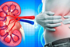Böbrek kumu dökme nedir? Belirtileri nelerdir? 9 böbrek kumu