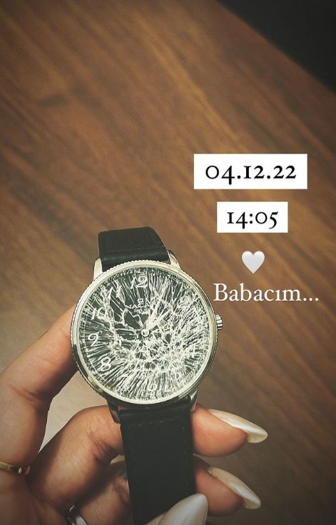 Özge Ulusoy’dan yürek burkan paylaşım! Kazada kaybettiği babasının kırılan saatini paylaştı