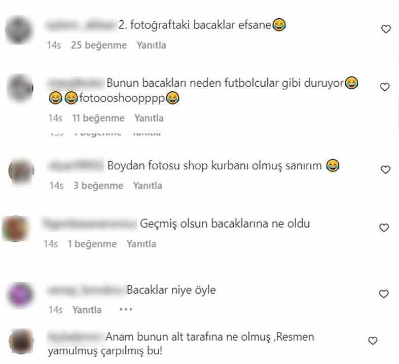 Photoshop’un ayarını kaçıran Hadise sosyal medyada alay konusu oldu: “Geçmiş olsun, bacaklarına ne oldu?”