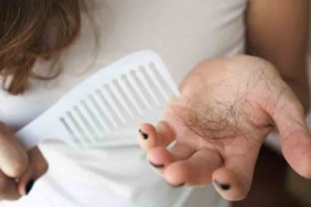 Saç dökülmesine son veren kür tarifi: Dökülen saçları yeniden çıkarıyor! 8 Saç-dökülmesinin-sebebi-ne--Bu-yöntem-ile-saç-dökülmesini-tersine-çevirebilirsiniz!