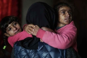 Hastalık nedeniyle konuşamıyorlar: Nadir cilt hastalığına yakalanan küçük kız kardeşler, güneşten korunarak yaşıyor 10 Hastalık-nedeniyle-konuşamıyorlar--Nadir-cilt-hastalığına-yakalanan-küçük-kız-kardeşler,-güneşten-korunarak-yaşıyor