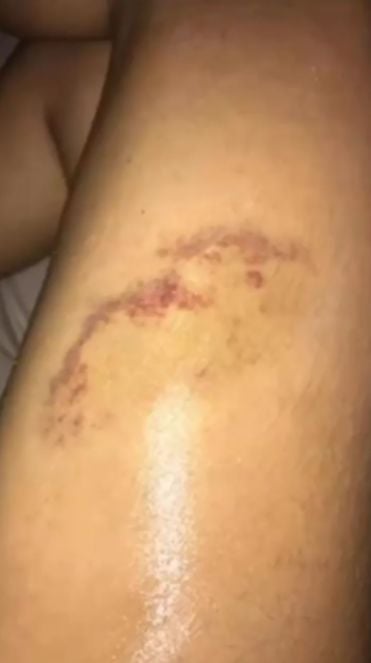 Süper Lig'in eski yıldızı Welliton'dan eşine 6 yıl boyunca işkence! Dehşete düşüren görüntüler ortaya çıktı 3 Süper Lig'in eski yıldızı Welliton'dan eşine 6 yıl boyunca işkence! Dehşete düşüren görüntüler ortaya çıktı