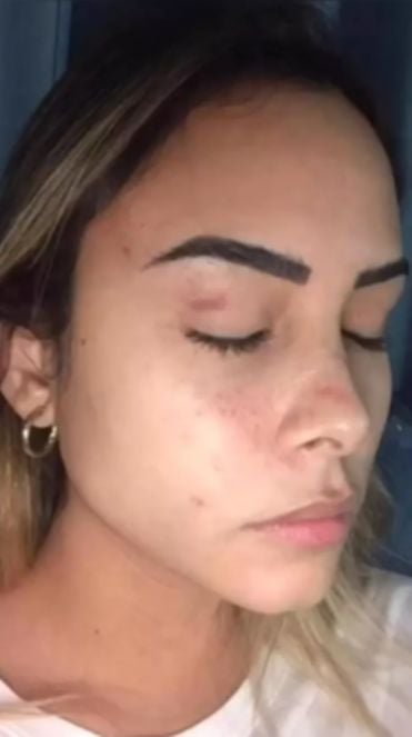 Süper Lig'in eski yıldızı Welliton'dan eşine 6 yıl boyunca işkence! Dehşete düşüren görüntüler ortaya çıktı 3 Süper Lig'in eski yıldızı Welliton'dan eşine 6 yıl boyunca işkence! Dehşete düşüren görüntüler ortaya çıktı