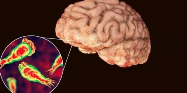 ABD’de-beyin-yiyen-amip-bir-kişinin-ölümüne-yol-açtı-