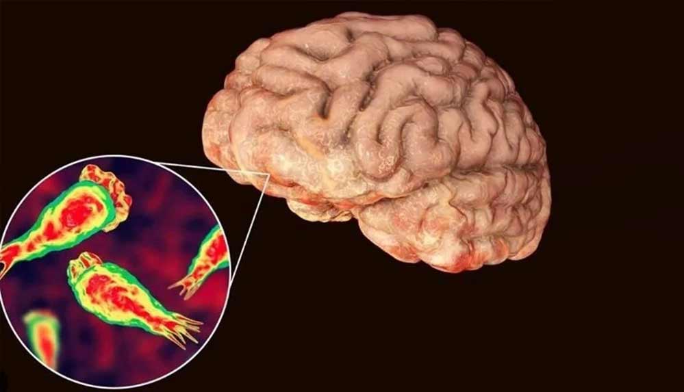 ABD’de beyin yiyen amip bir kişinin ölümüne yol açtı: Musluk suyundan enfekte oldu
