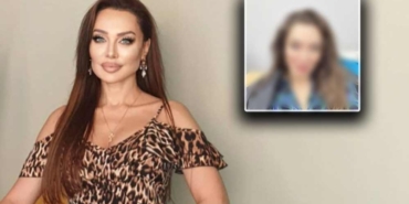 Estetiğin-dozunu-kaçıran-Umut-Akyürek-tanınmaz-hale-geldi!-“Neden-kendinize-bunu-yaptınız-”