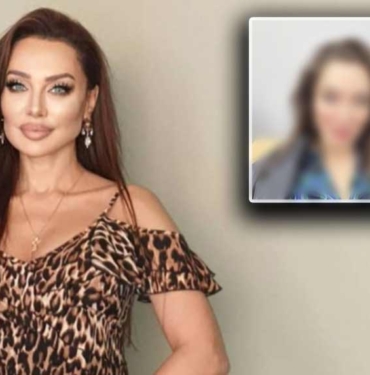 Angelina Jolie'ye benzemek için estetiğin dozunu kaçıran Umut Akyürek tanınmaz hale geldi! “Neden kendinize bunu yaptınız?” 2 Estetiğin-dozunu-kaçıran-Umut-Akyürek-tanınmaz-hale-geldi!-“Neden-kendinize-bunu-yaptınız-”