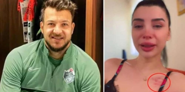 Gözyaşları-içinde-paylaştı--İşte-Benim-Stilim-yarışmacısı-Aleyna-Eroğlu,-futbolcu-sevgilisi-Batuhan-Karadeniz’den-şiddet-gördüğünü-iddia-etti