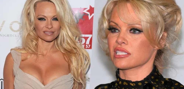 Pamela Anderson’dan yıllar sonra gelen cinsel istismar itirafı! “12 yaşındayken…” 6 Pamela-Anderson